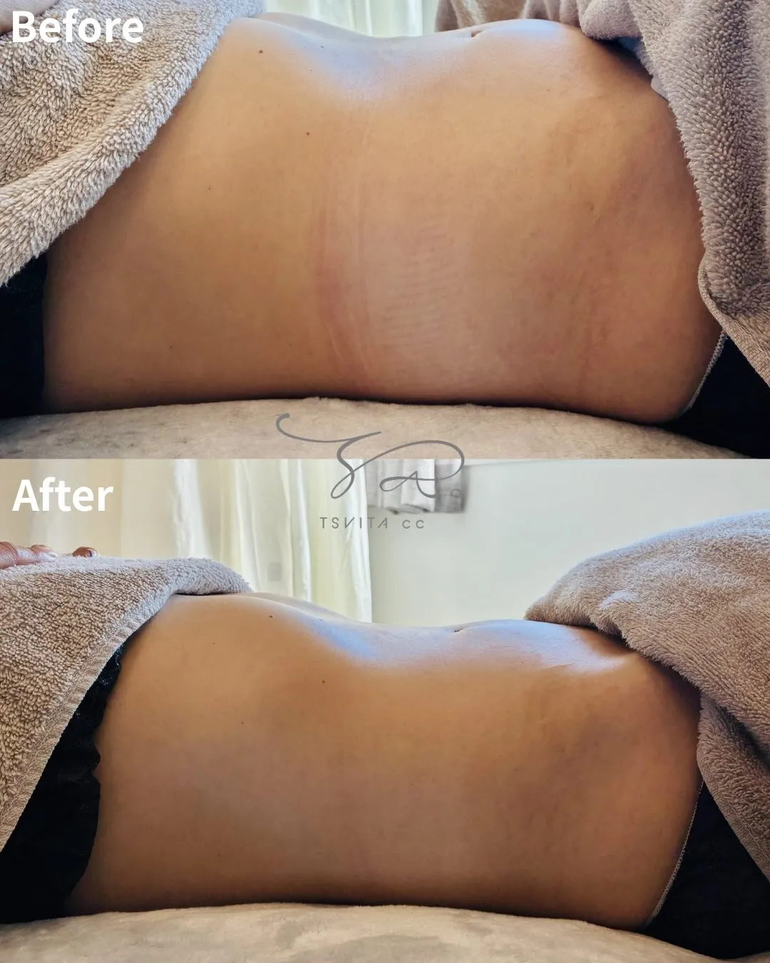 自分のお腹が張っていると気付いていますか？