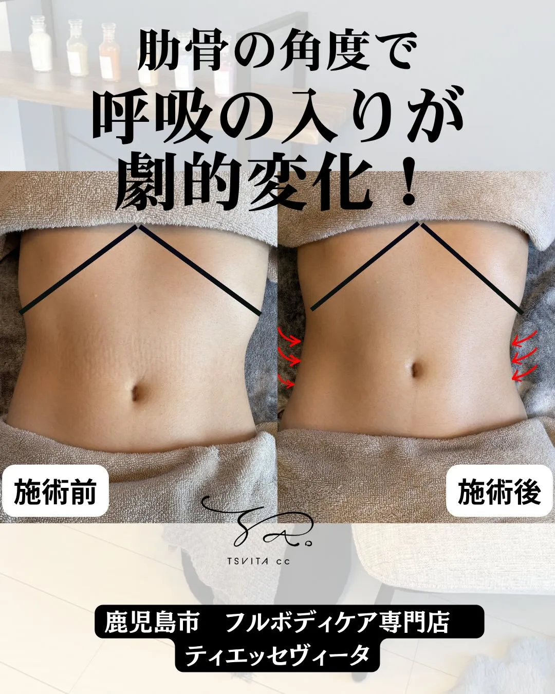 腸もみで肋骨調整が重要ってしていますか？
