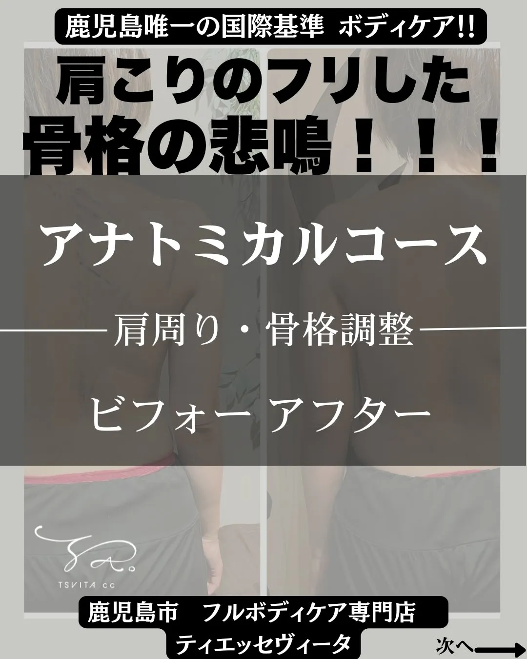 「腕が上がらない・上がりづらい…」