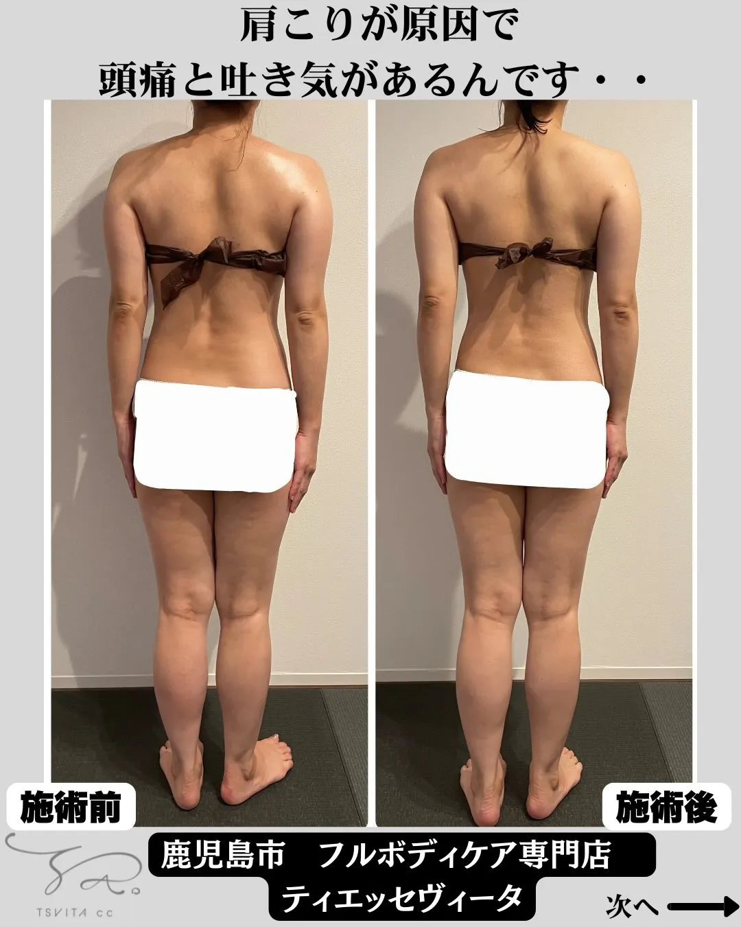 「肩こりが酷すぎて頭痛と吐き気が凄いんです…」