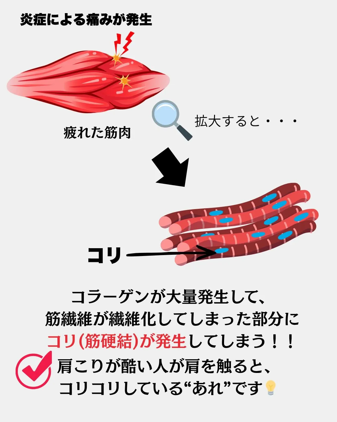 みなさんは良く耳にする「コリ」がなんなのか…