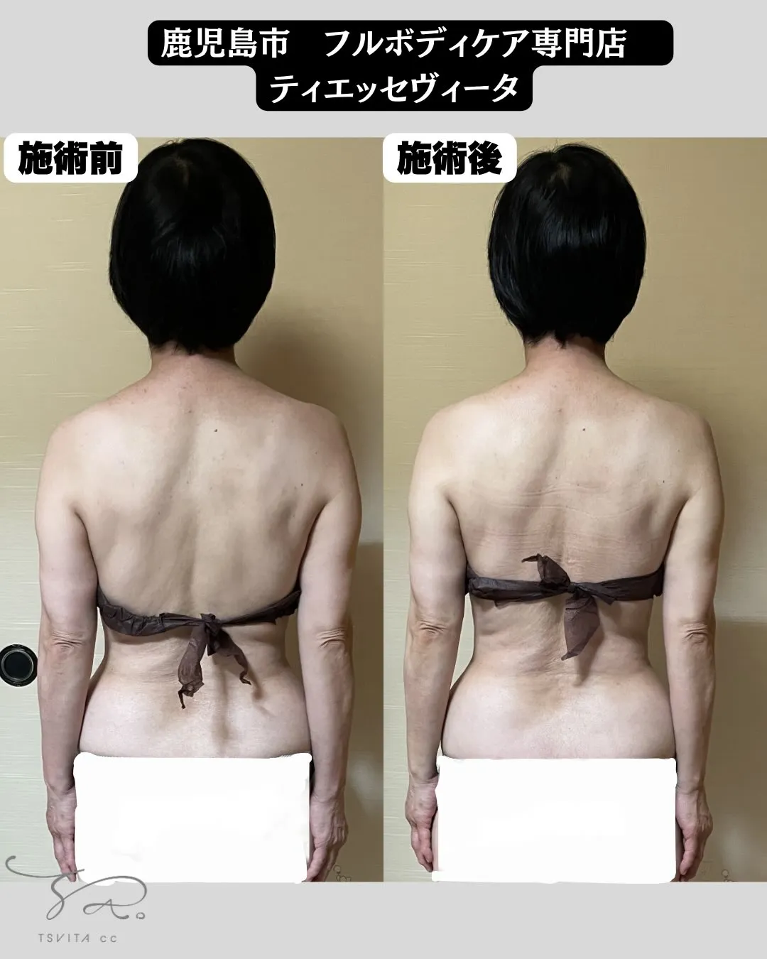 【コリ】についてたくさんのご質問をいただきましたので、