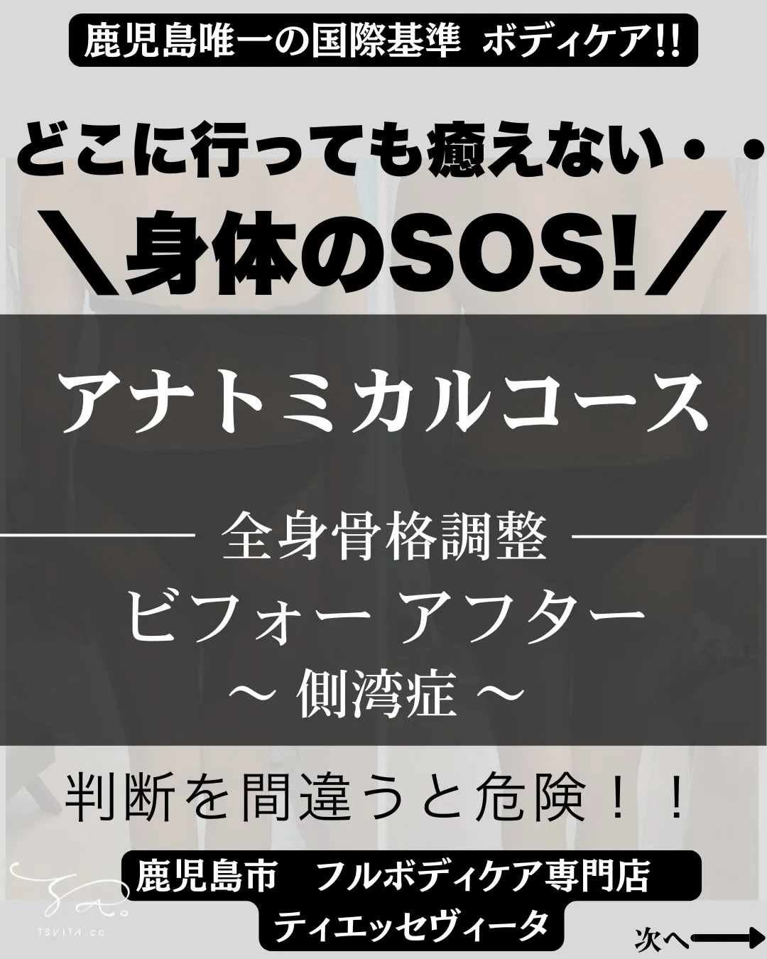 意外に多くおられる【側湾症】!!