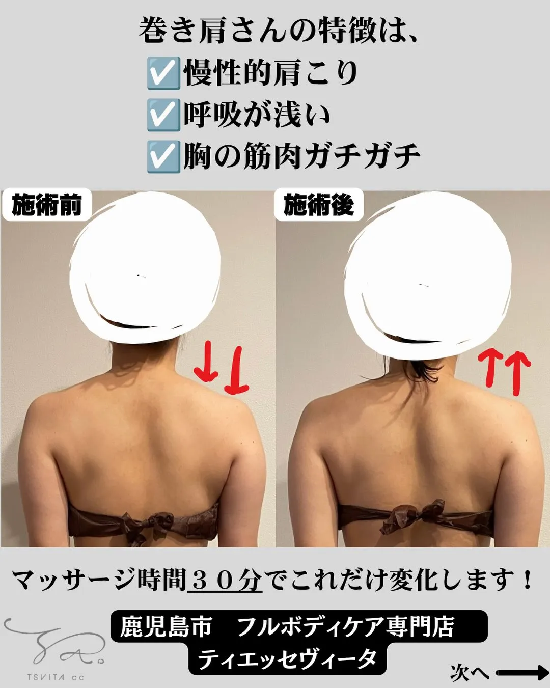 巻き肩は、コリを育てるだけでなく呼吸も潰す‼️