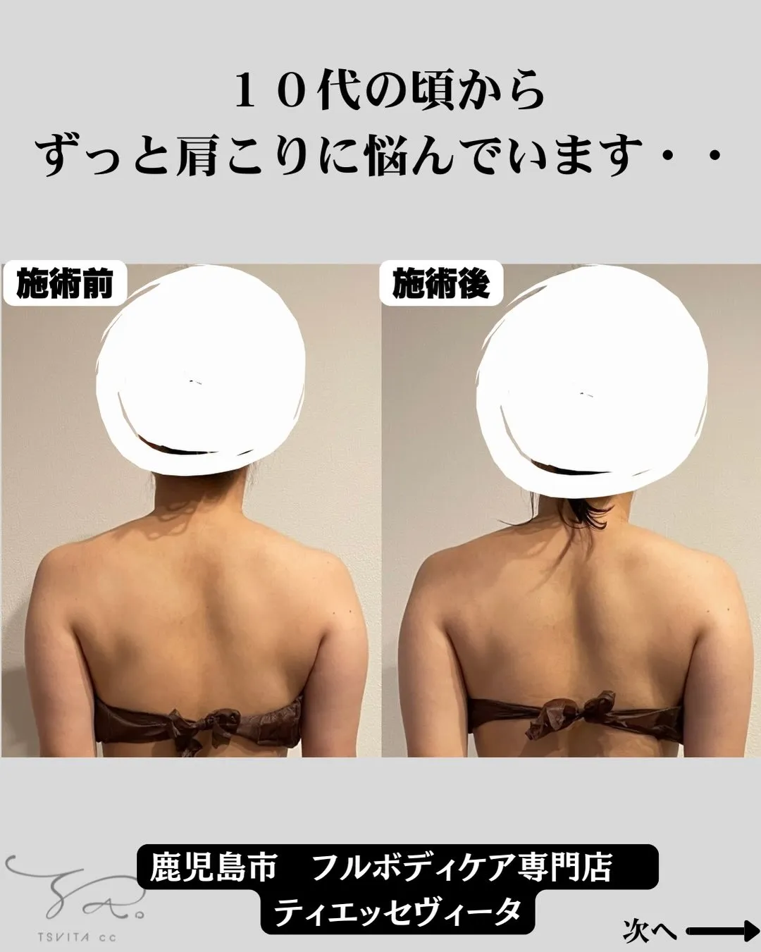 巻き肩は、コリを育てるだけでなく呼吸も潰す‼️