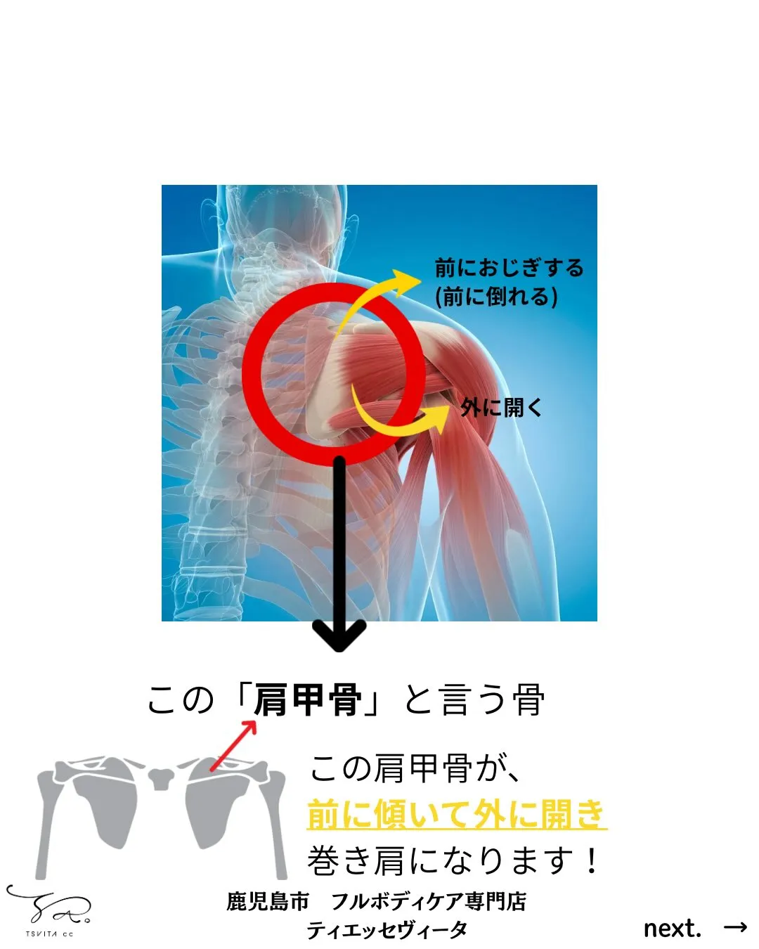皆さんは腕を動かした時に痛みがでたことがありますか?