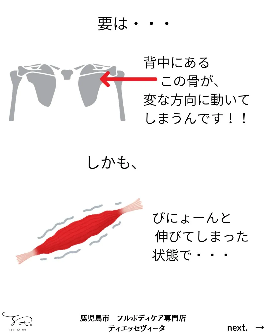 皆さんは腕を動かした時に痛みがでたことがありますか?