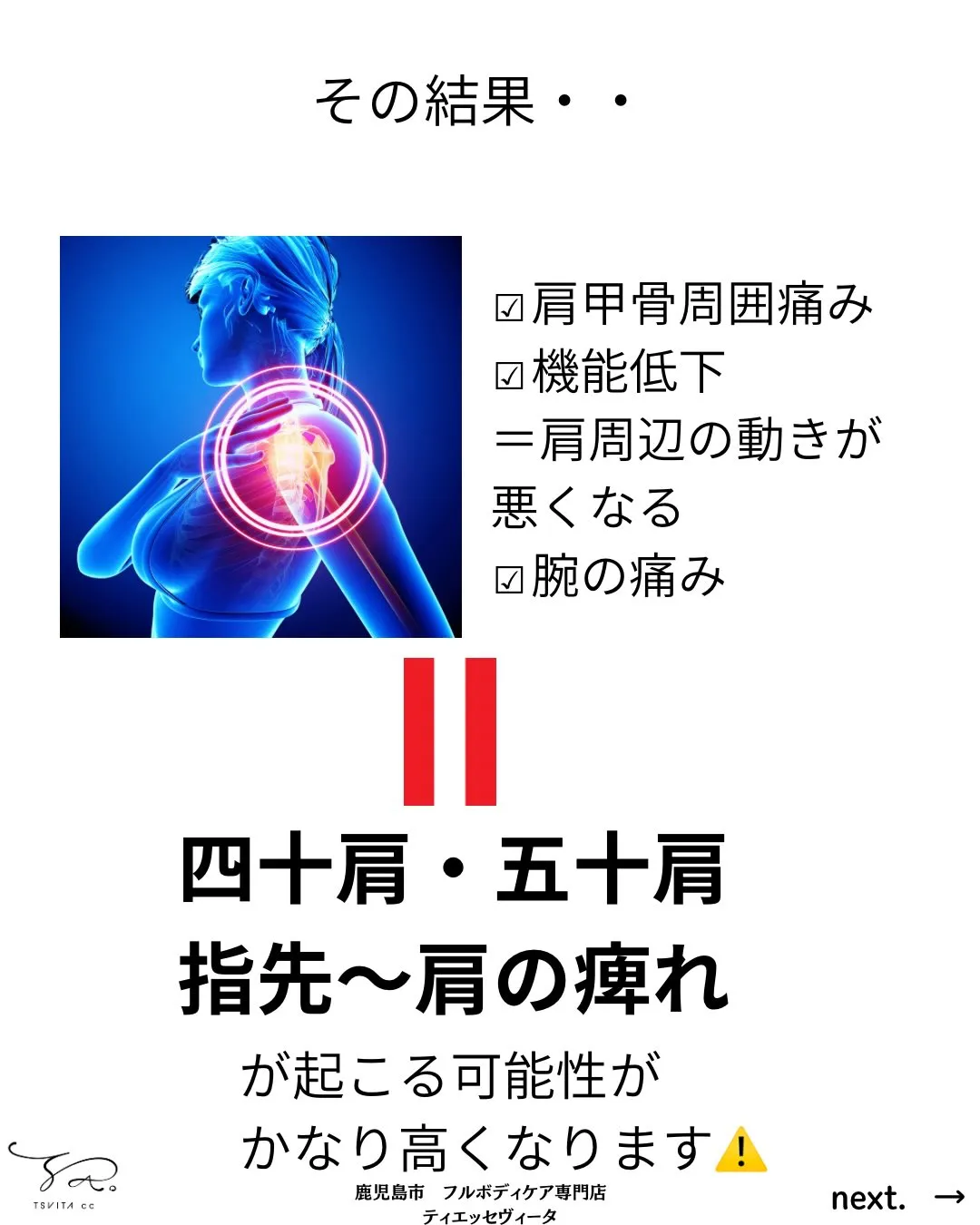 皆さんは腕を動かした時に痛みがでたことがありますか?