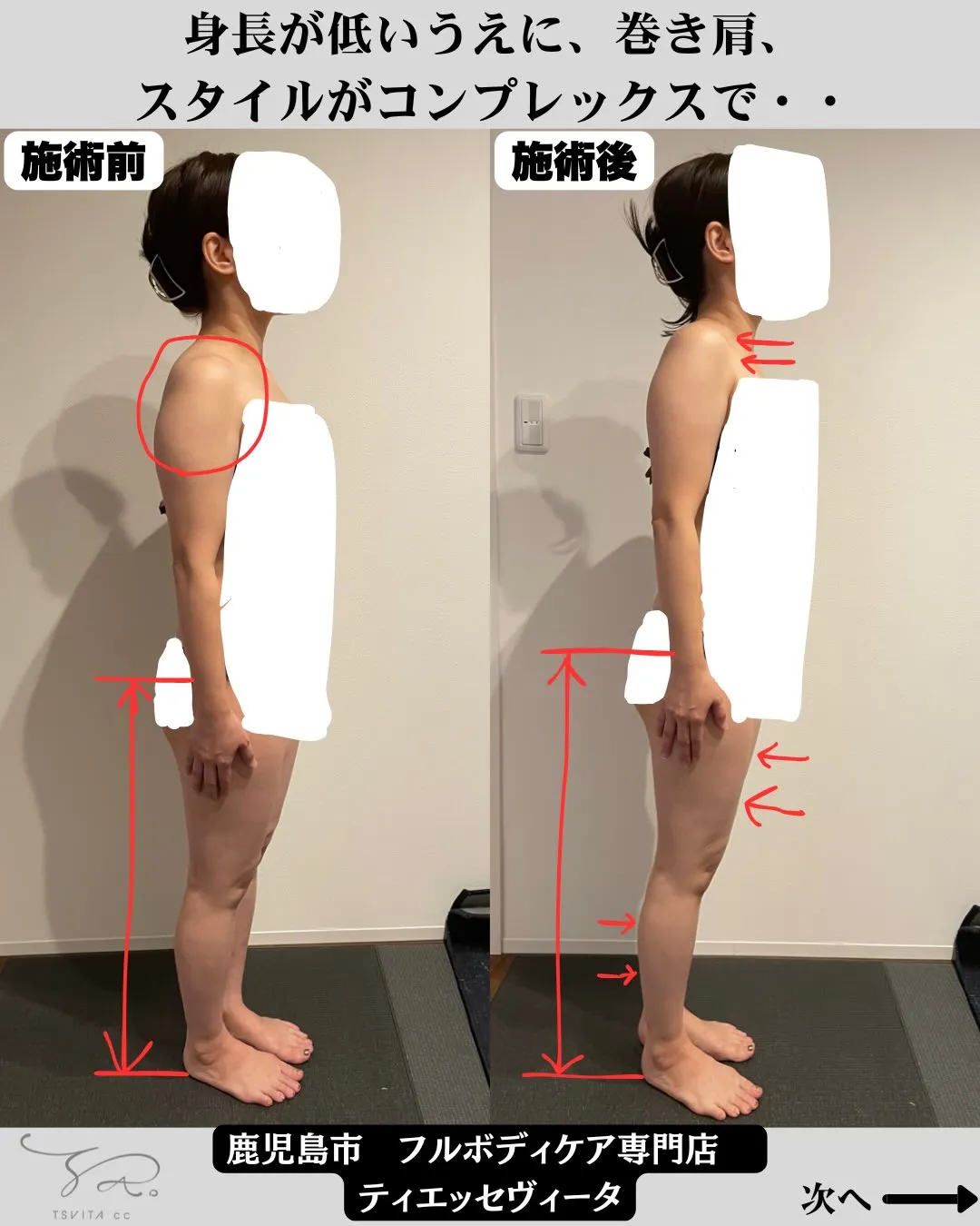「学生の頃から体型のコンプレックスがありました。