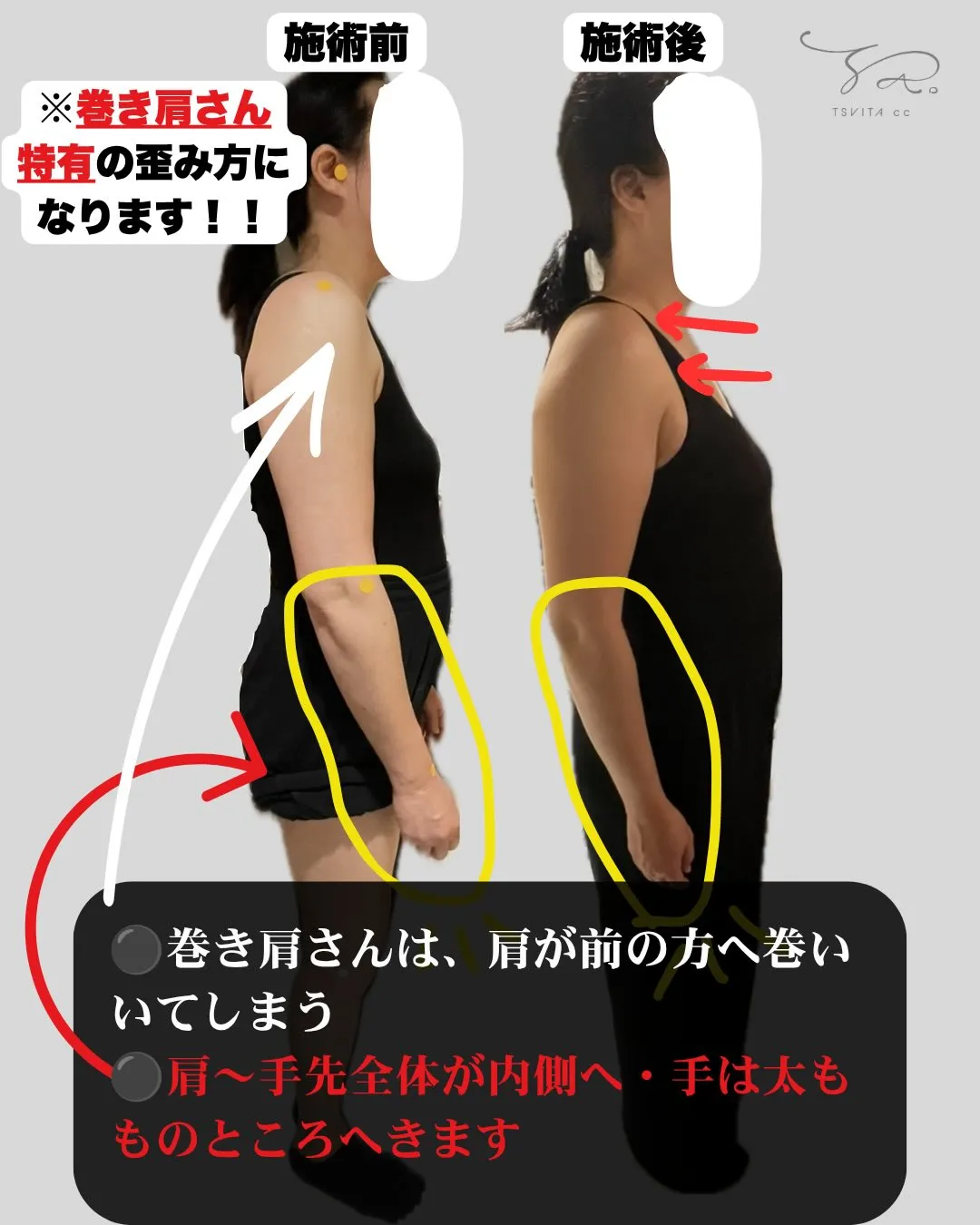 巻き肩さん！