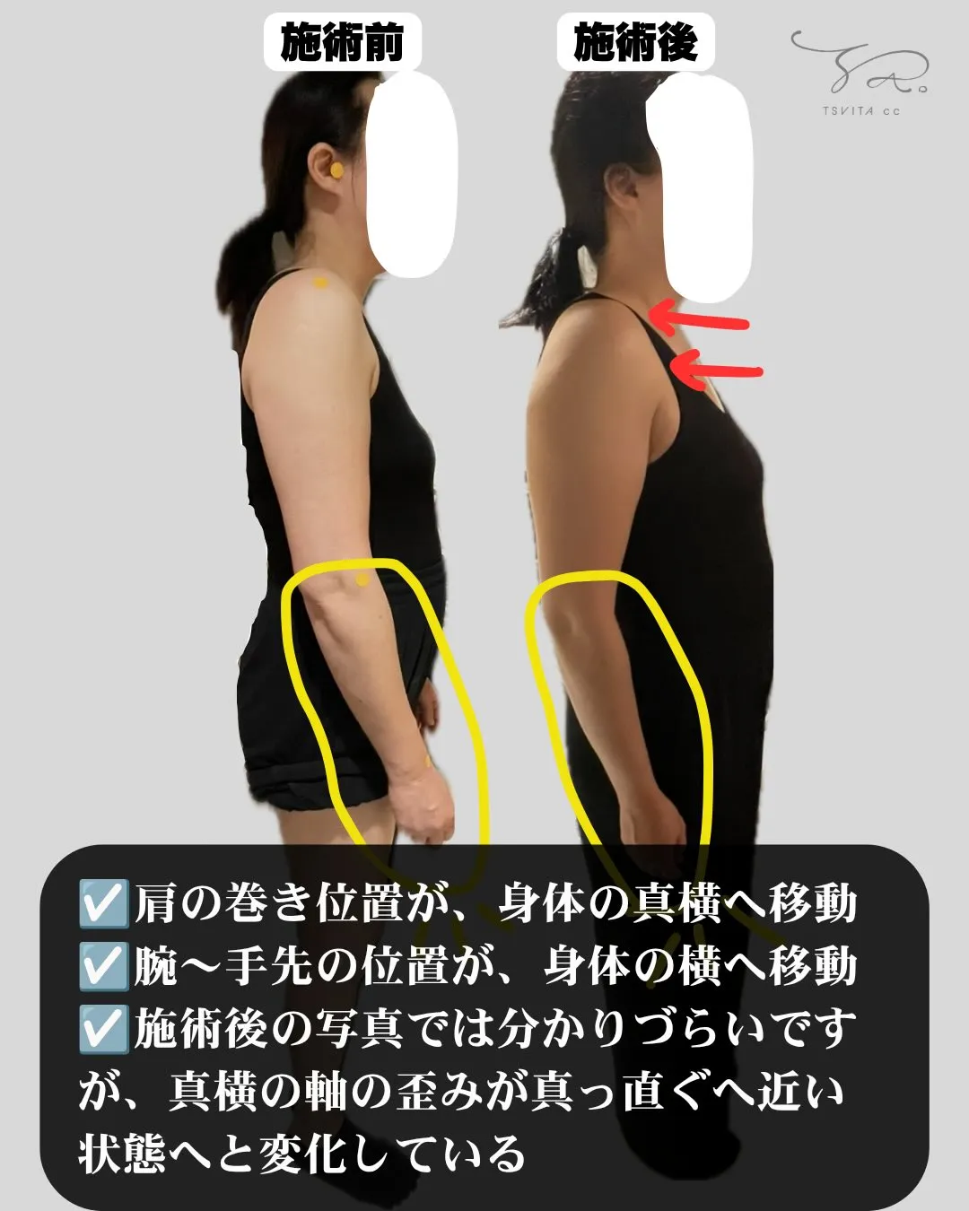 巻き肩さん！