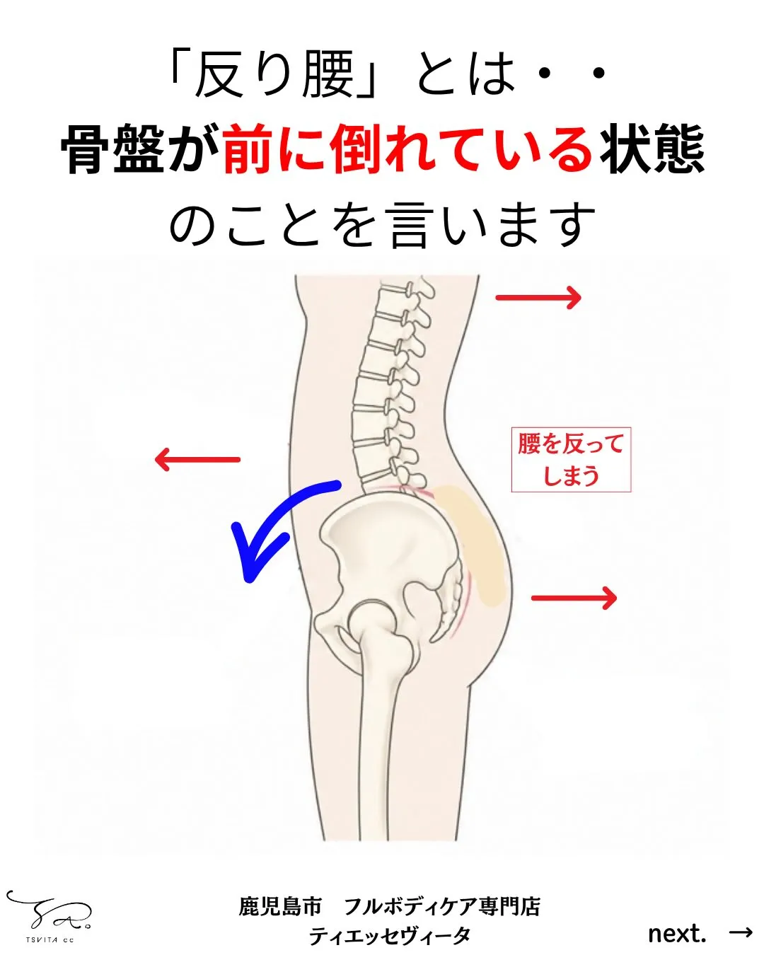 「お尻が突き出て嫌なんです」