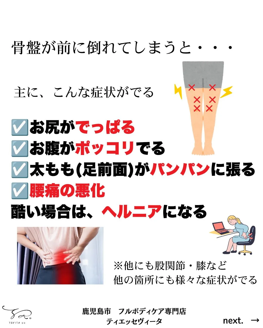 「お尻が突き出て嫌なんです」