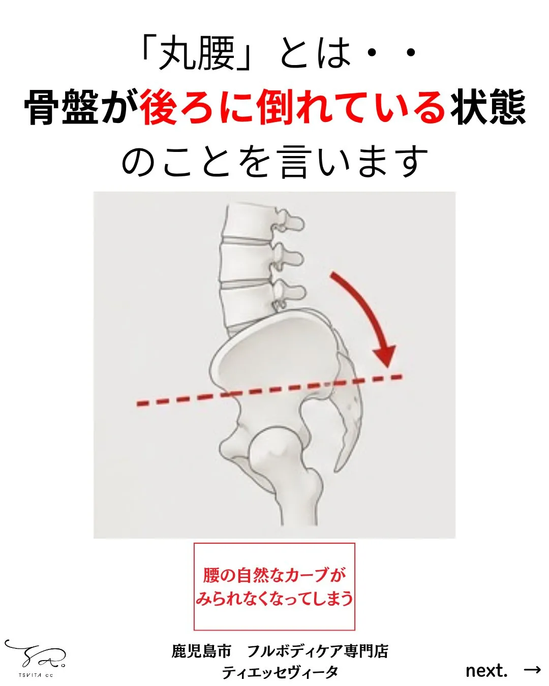 あなたのお尻はハッキリと丸みの分かるお尻ですか?