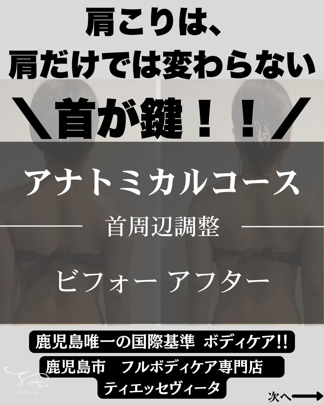 あなたの肩・首・背中のキツさの原因がどこなのか知っていますか...