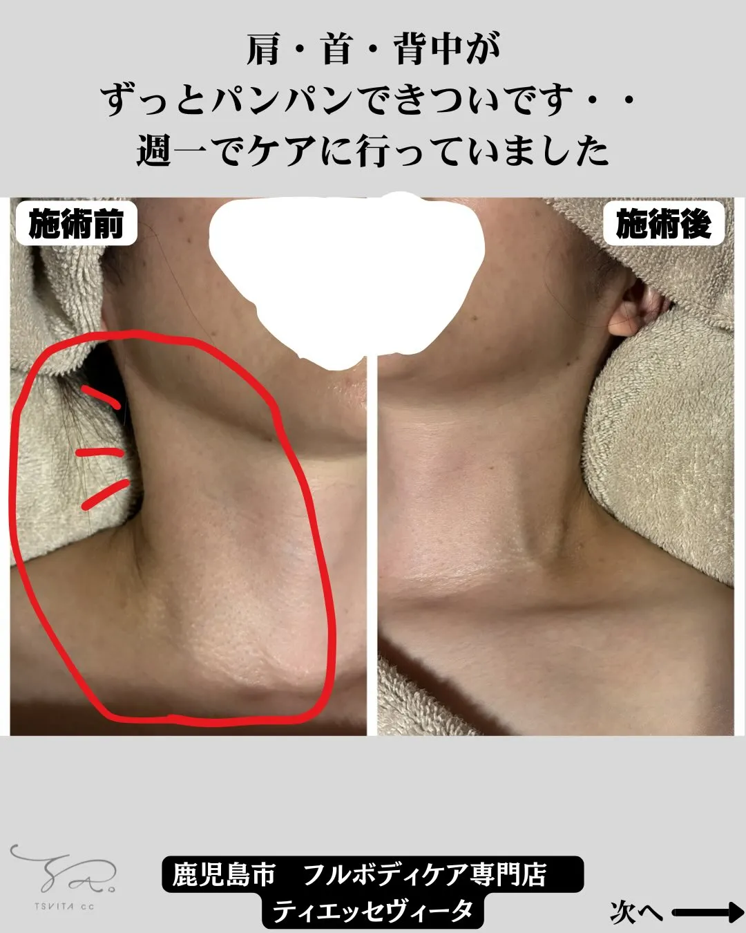 あなたの肩・首・背中のキツさの原因がどこなのか知っていますか...