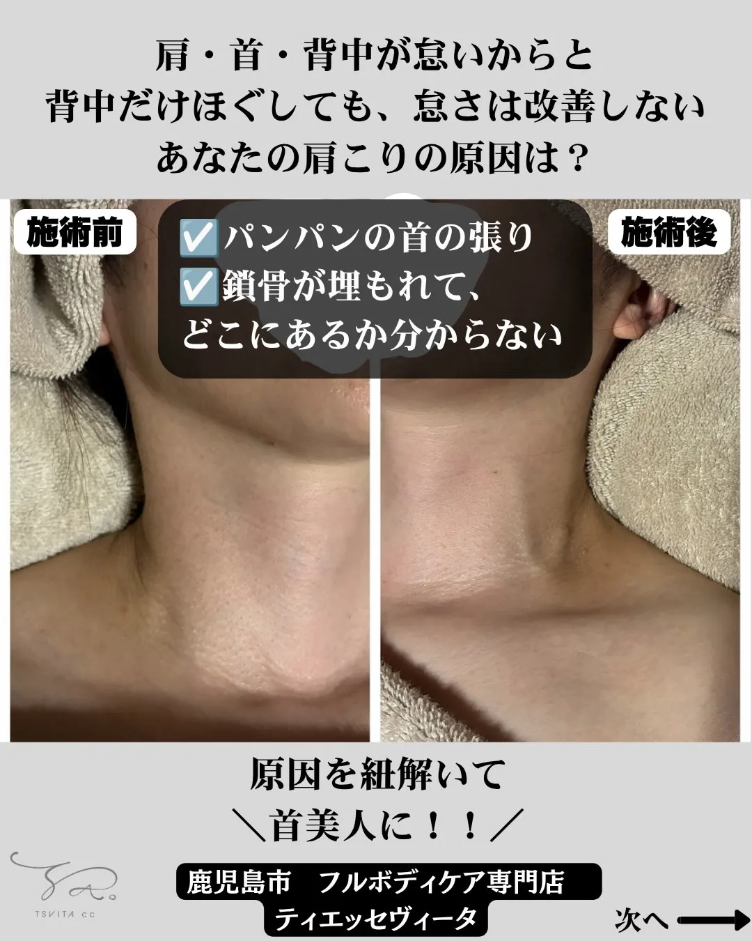 あなたの肩・首・背中のキツさの原因がどこなのか知っていますか...