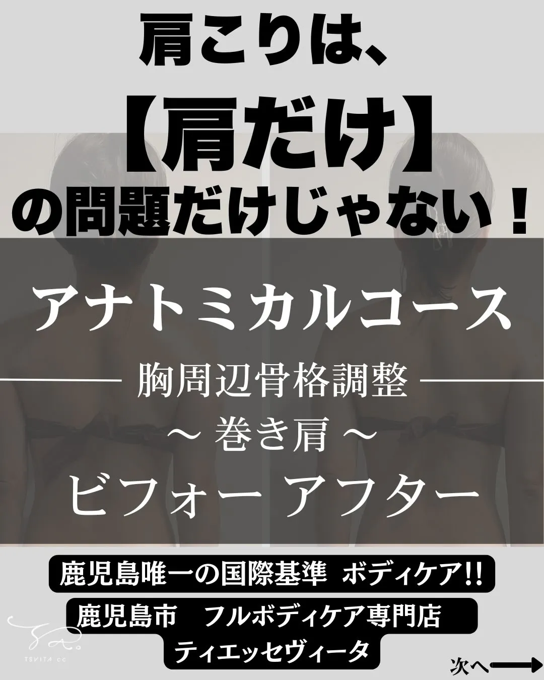 皆さんは肩こりがありますか?