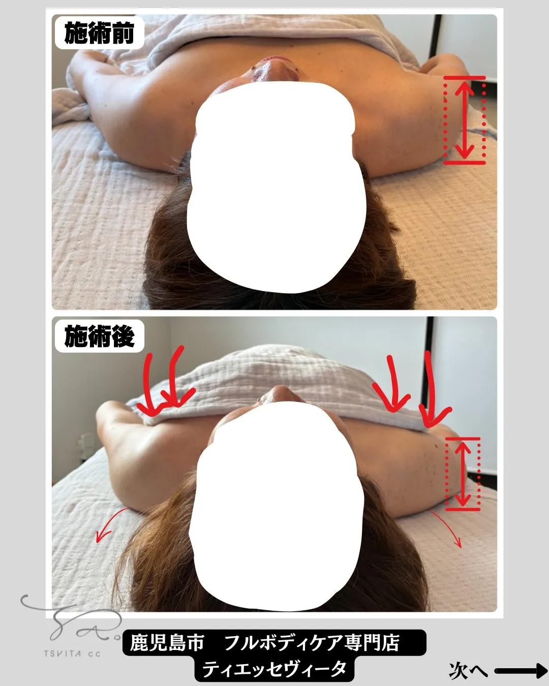 皆さんは肩こりがありますか?