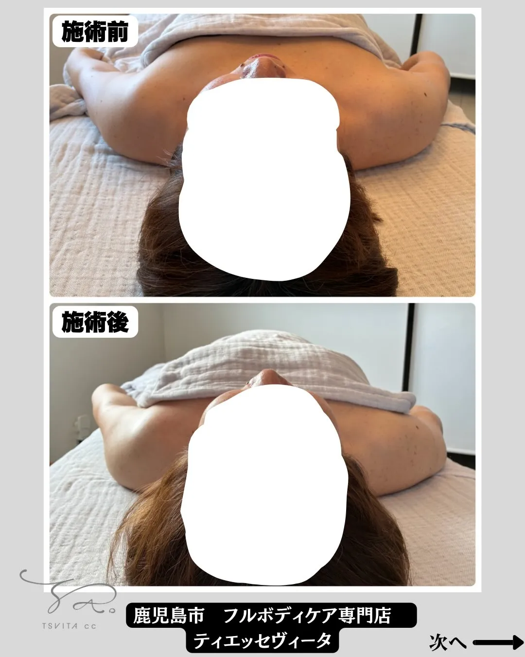 皆さんは肩こりがありますか?