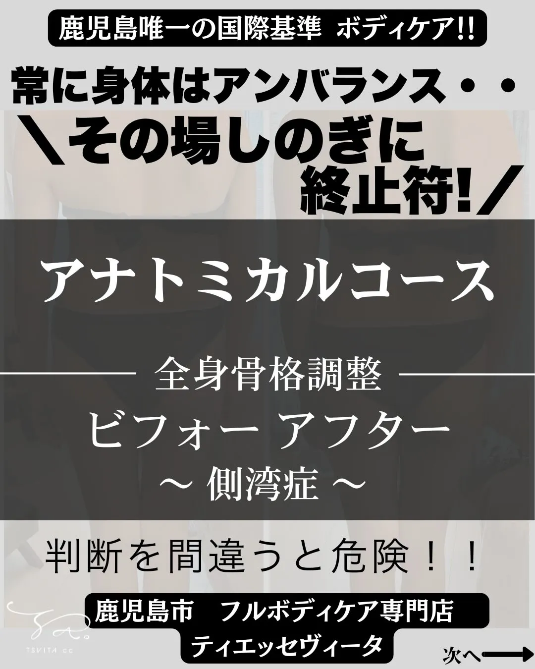 「小学生の頃に側湾症が分かって…