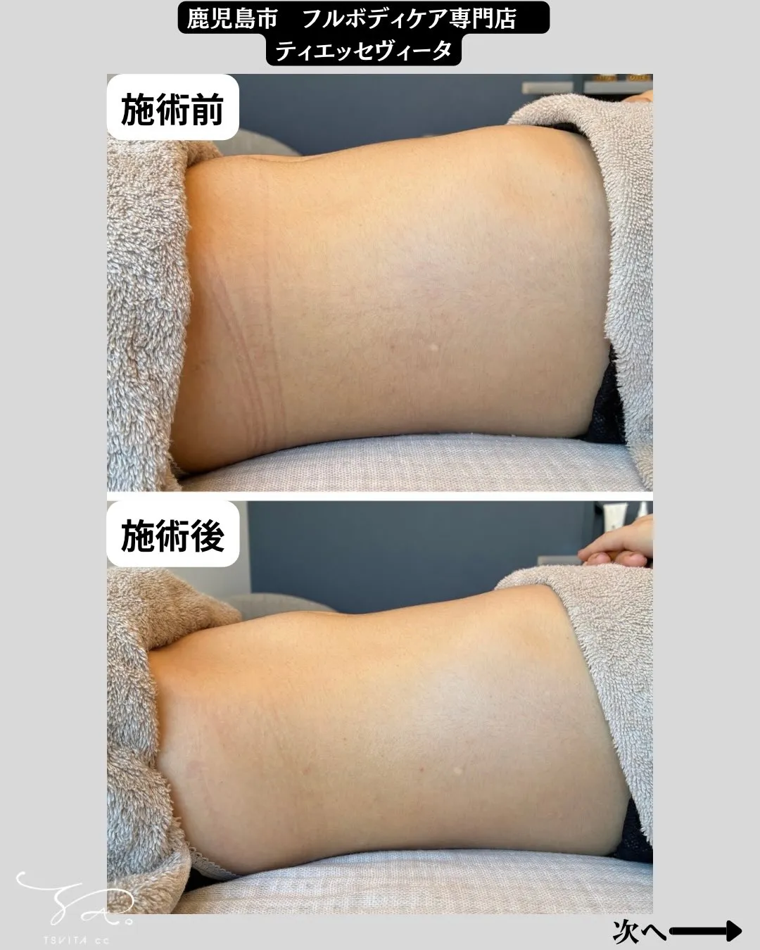 ただ単に腸を揉むだけではない‼️当店の腸・内臓ケア🔥