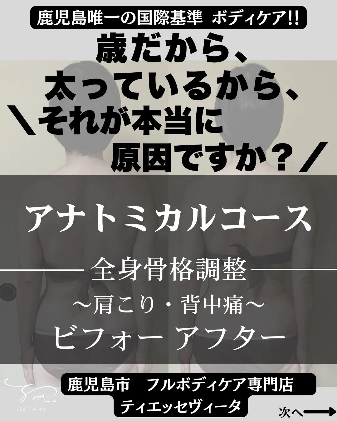 「どうせ歳だから！太っているから！昔からだから！」