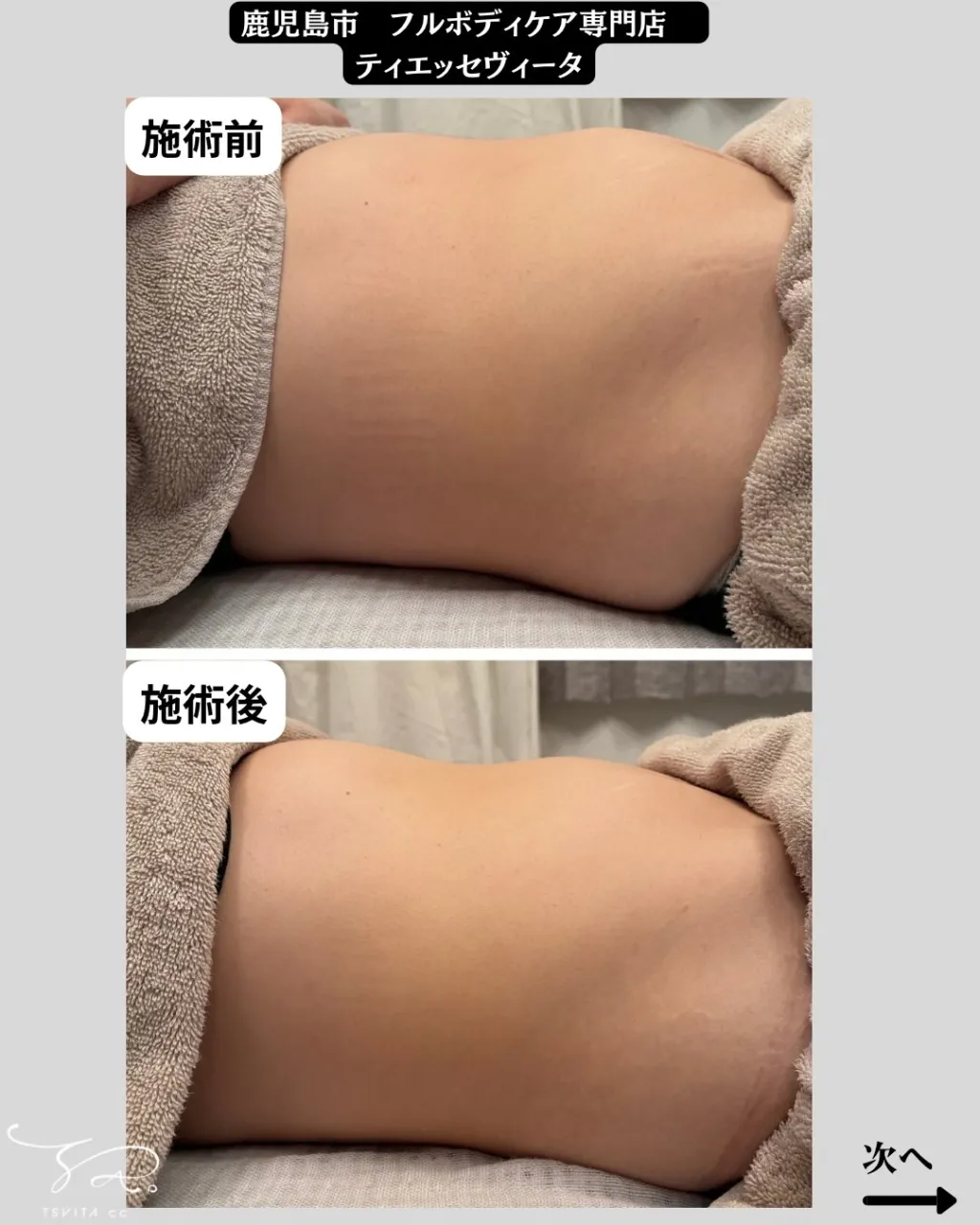 お腹はパンパンに張っていませんか？