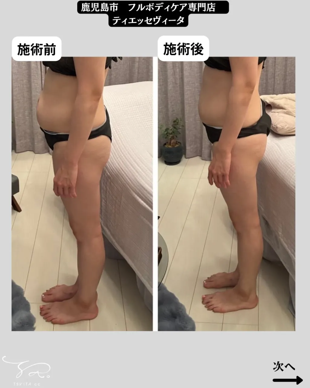 「お腹の状態は心・精神が関係することをご存知ですか?」