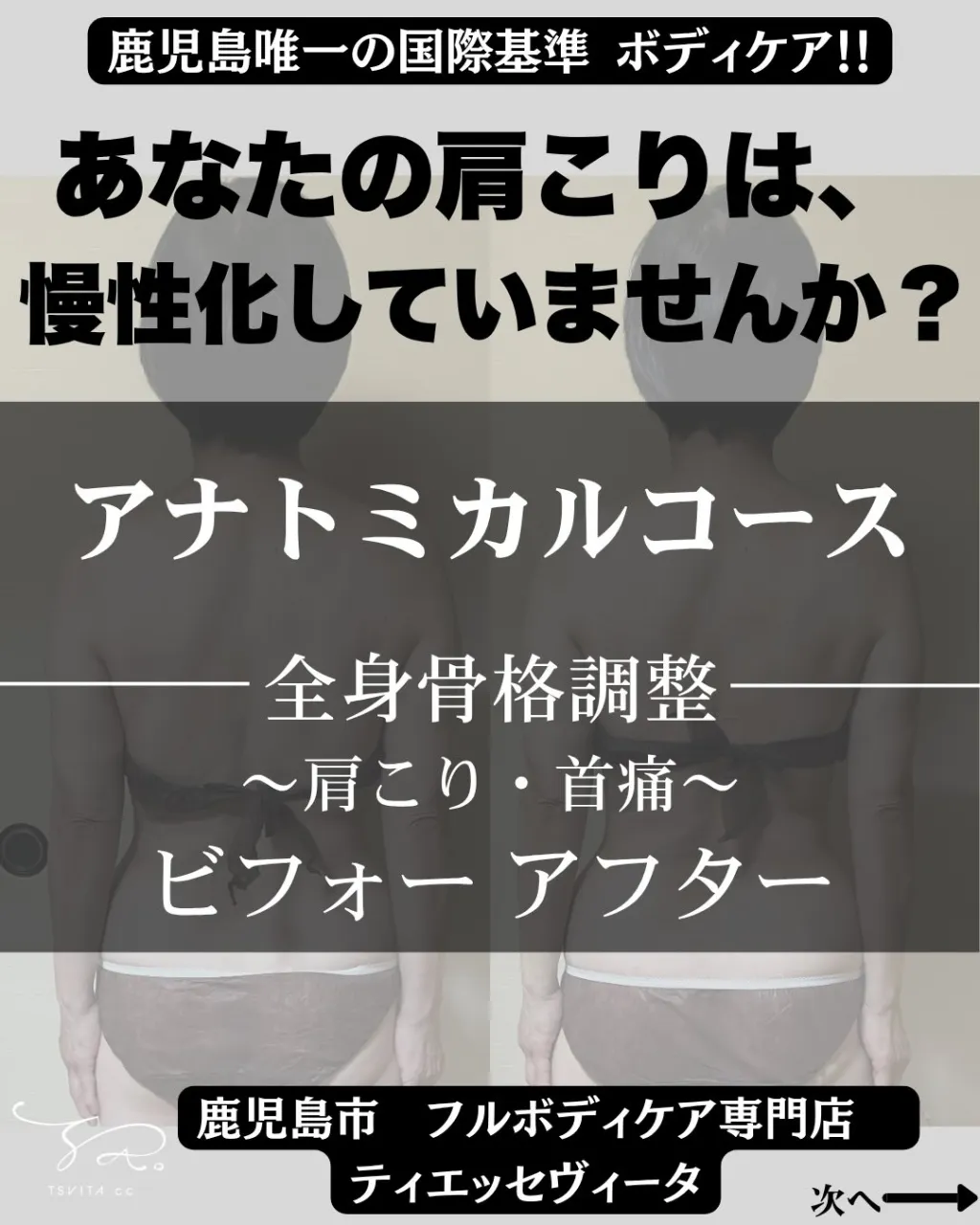 「私肩こりはいつもあるので…もう慣れて肩こりがあるけど痛みは...