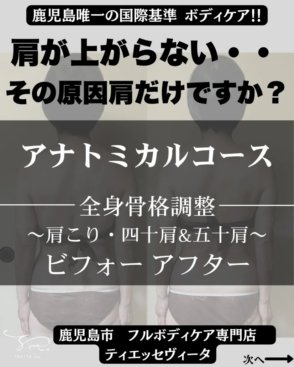 背中が反っているからと、「反り腰」と判断していませんか?