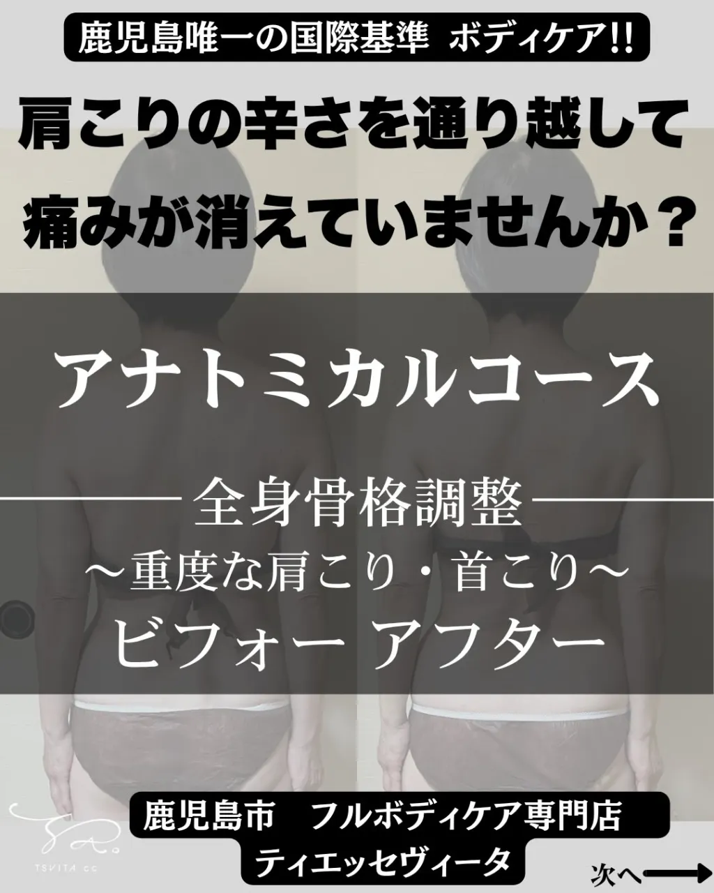 「肩こりはありますか?巻き肩ですか?」